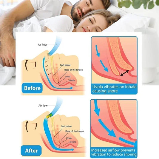 Anti Snore Stop Snoring Nose Clip Silicone Magnetic Sleep Tray Sleeping Aid Apnea Guard Night Device with Case Anti